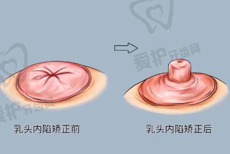 姚然医生真实的患者口碑评价
