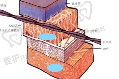 姚然医生技术特色