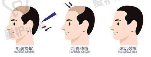 侯智慧医生擅长项目