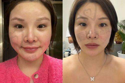 深圳联合丽格整形美容医院电话全揽