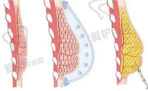 李奇军 医生技术特色