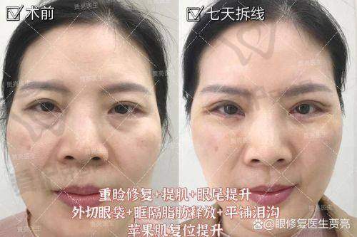 患者的真实口碑评价