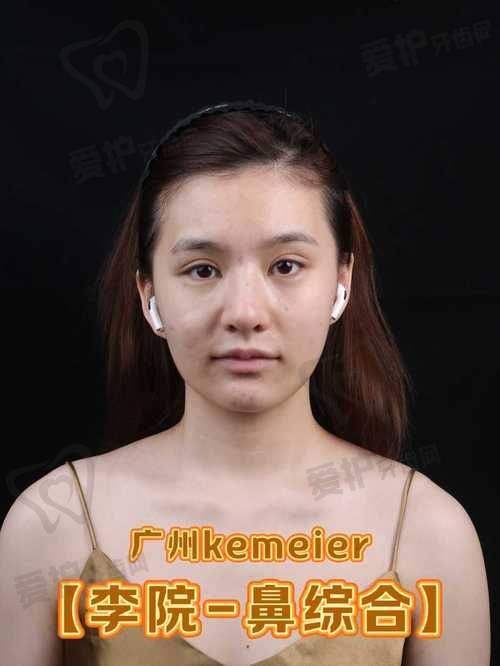 贵州利美康外科医院做肋软骨鼻综合的具体优势