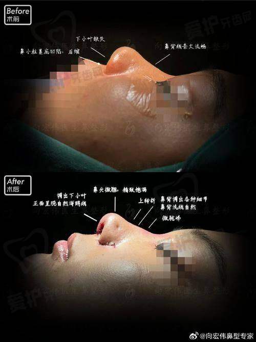 贵州利美康外科医院肋软骨鼻综合相关医生详细介绍