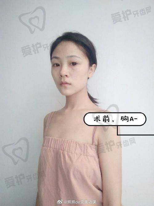 淮安华美自体脂肪丰胸9750元起，先进技术、专业团队与优质服务打造自然丰满美胸