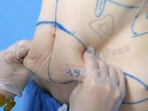 美容手术包含哪些项目？