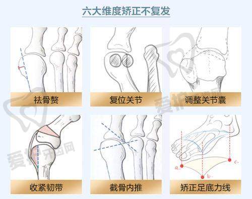 胶原蛋白和玻尿酸填充法令纹的原理分别是什么？