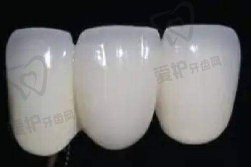在决定磨短门牙前需要做哪些准备？