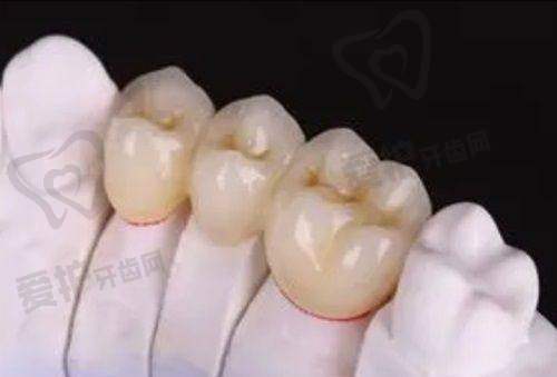 沈阳亿美齿科门诊部正规吗