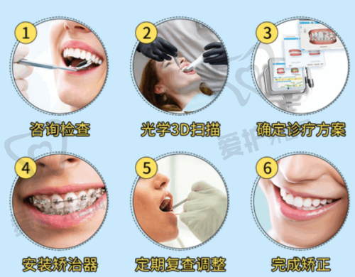适用人群方面,隐形牙套和钢丝牙套哪种能更好地满足不同需求,从而达到更好的成效?