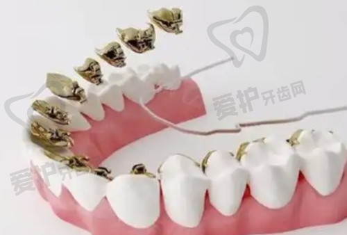 贴牙片对真牙齿有直接影响吗？