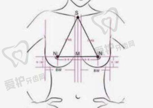 体雕和抽脂在美学适配性上有什么不同?