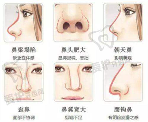 整形美容外科的手术分级是怎样的？