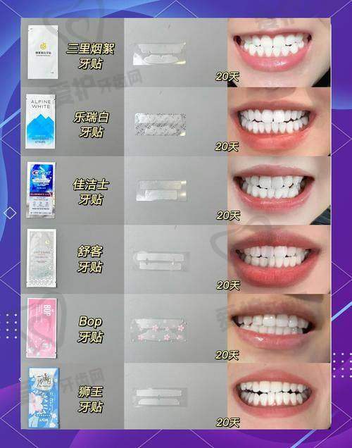运城美瑞臣口腔做皓齿美白的具体优势