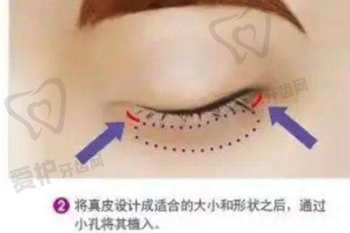 如何选择适合自己的医生?
