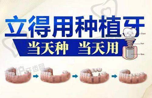 正畸医生:为您打造整齐美牙