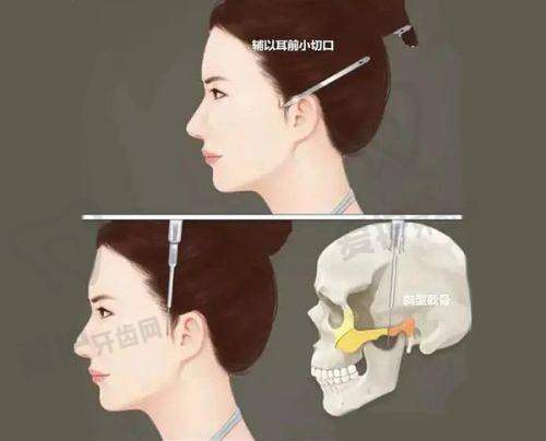 设备设施与服务差异,如何选择?