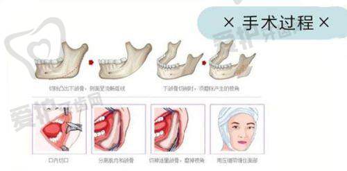 杭州排名前 3 的整形医院