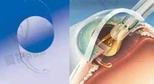 总结