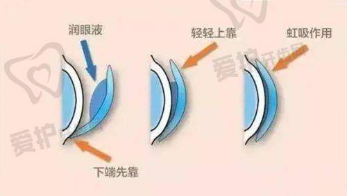 乌鲁木齐普瑞眼科医院高新院口碑如何?