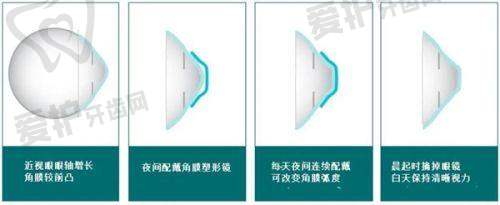 哈尔滨普瑞眼科的服务亮点是什么?