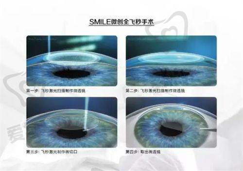 哈尔滨爱尔眼科的服务特色有哪些?