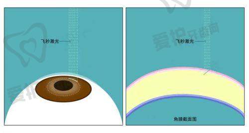 哈尔滨普瑞眼科的口碑怎么样?