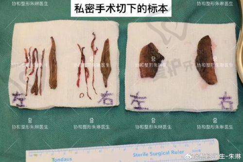 北京嘉禾医院在女性私密整形方面的保护