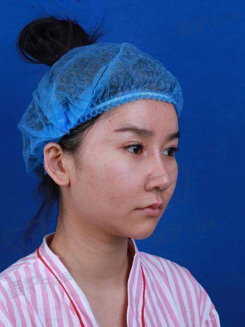 长沙梵童医疗美容吸脂技术与成效如何？