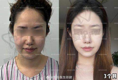 长沙梵童医疗美容的整体情况及吸脂优势总结