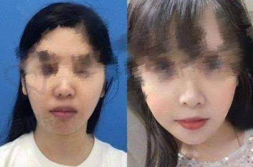 五、上海伯思立（翡立思）预约挂号流程：