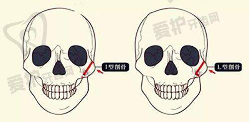 南京艺星汪树杰医生患者评价