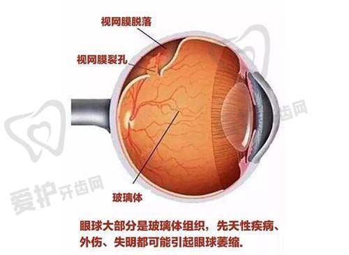 顺德爱尔眼科医院价格参考与就医建议