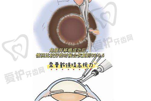 七、湖北恩施慧宜眼科医院患者评价：
