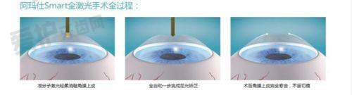 精良设备:精细治疗的关键