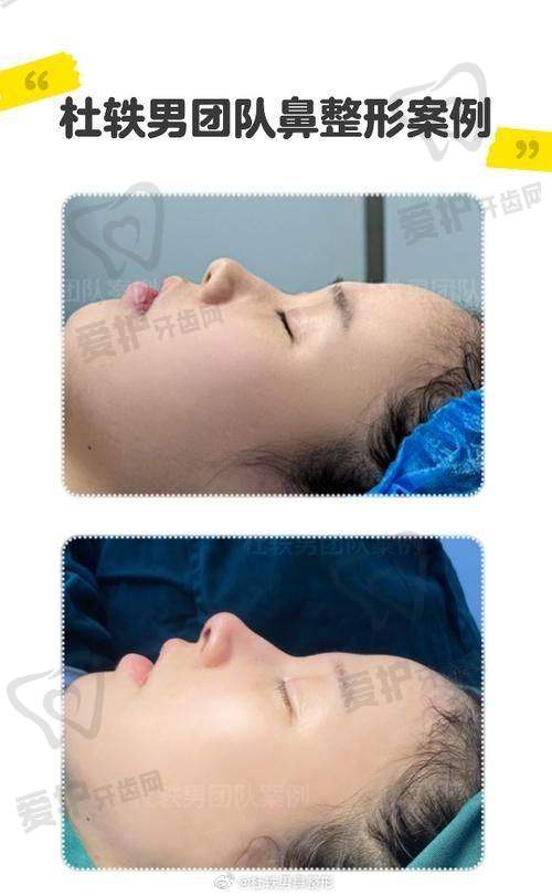 术后修复：46000元起的项目需要注意什么？