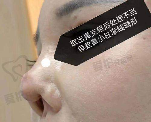 牛克辉院长：出彩国内鼻的缔造者是谁？
