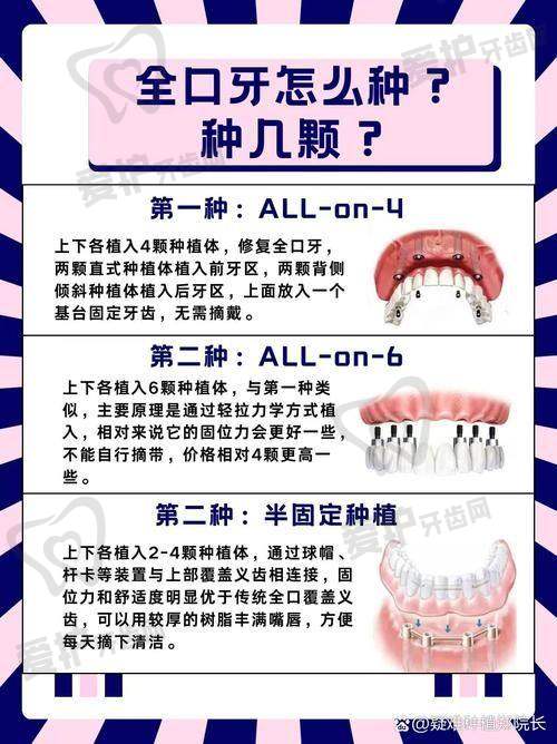 沈承骏医生在全口牙种植方面有哪些优势？