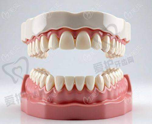 北京美冠塔口腔吸附性义齿的优势有哪些？