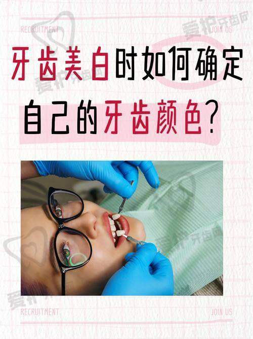 深圳正夫口腔牙齿美白后如何保持成效？
