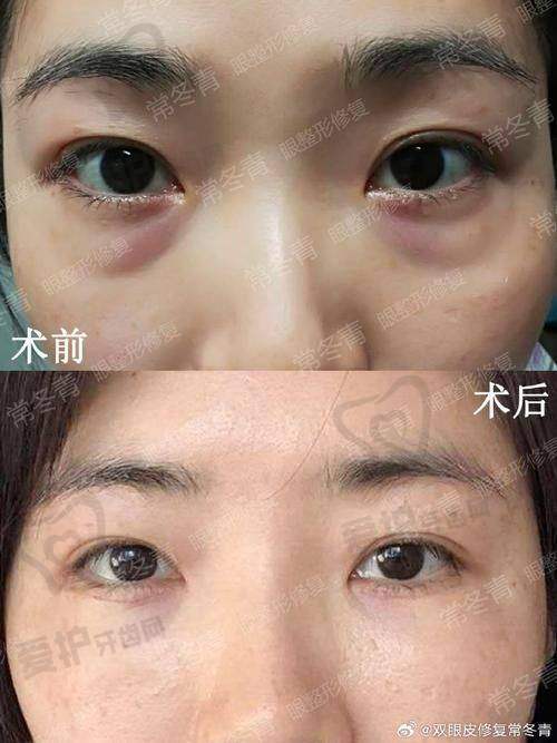广州美诗沁与其他医院相比有什么优势?