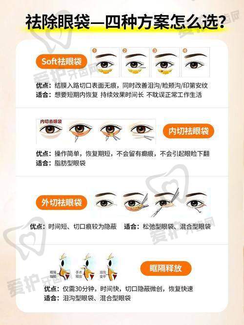 广州美诗沁不开刀去眼袋的成效能维持多久?
