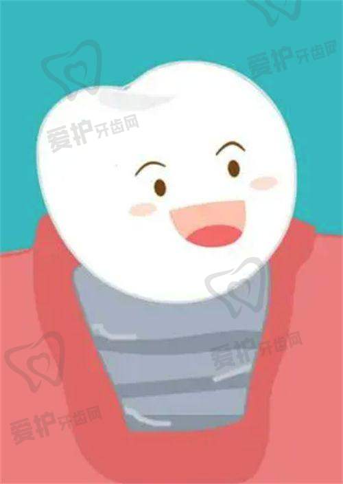 如何判断种植牙是否出现问题？