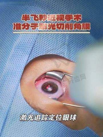 中山爱尔眼科医院半飞秒近视手术的流程是怎样的？