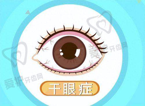 抚顺爱尔眼科治疗干眼症的优势