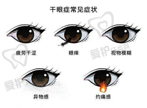 抚顺爱尔眼科干眼症治疗价格分阶情况