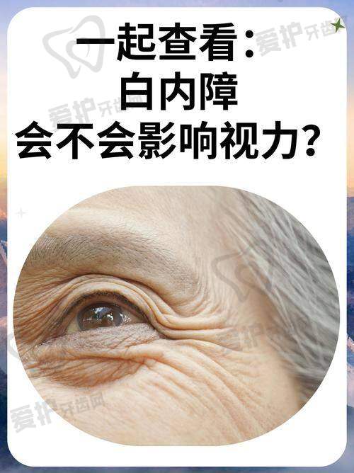 在潍坊明润眼科医院诊疗白内障需要注意什么?