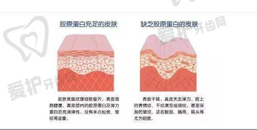 吴应凯医生隆鼻项目