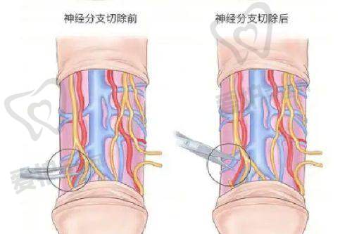 眼部整形项目