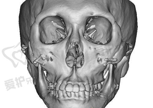 鼻面部整形项目